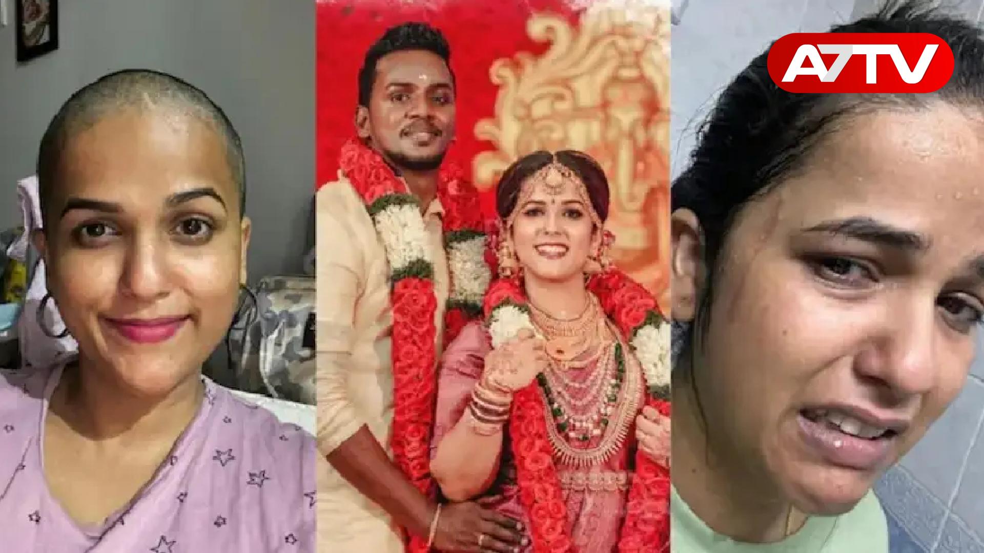 Read more about the article அழகா இருந்தது தப்பா? மொட்டை அடித்த கணவன்! பெண் எடுத்த விபரீத முடிவு