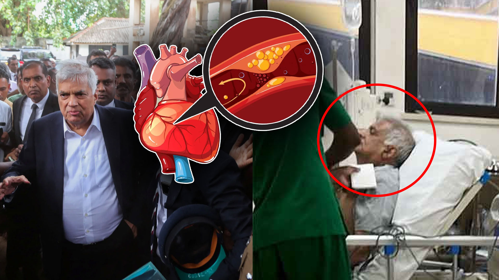 Read more about the article ரணில் விக்ரமசிங்கவுக்கு உடனடி இருதய அறுவைச் சிகிச்சை அவசியம்