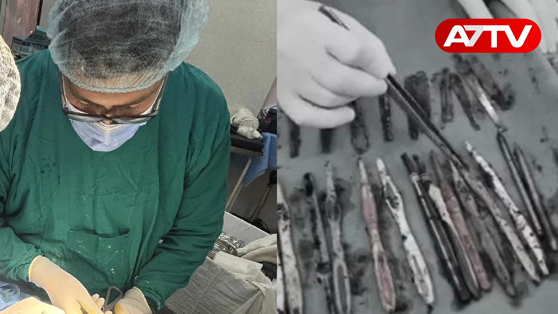 Read more about the article வாலிபர் வயிற்றில் இருந்த 29 கரண்டிகள், 19 பிரஷ்கள்: அதிர்ச்சியில் உறைந்த மருத்துவர்கள்