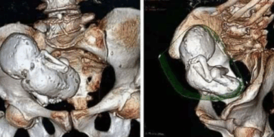 ct-scan
