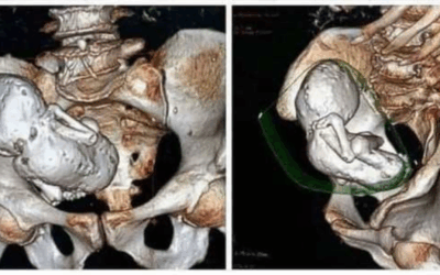 ct-scan